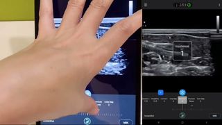 Линейный ультразвуковой датчик Golead для базальной вены