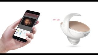 Marvoto Fetus Camera M1 — портативное 3D-УЗИ