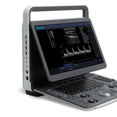 Купить 15,6» машин ультразвука LCD Sonoscape E2 с гарантией 2 год online manufacture