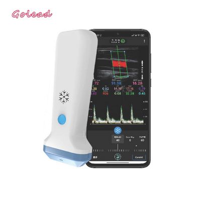 Купить тип блок развертки зонда 12MHz 3000mAh беспроводной ультразвука для Iphone online manufacture
