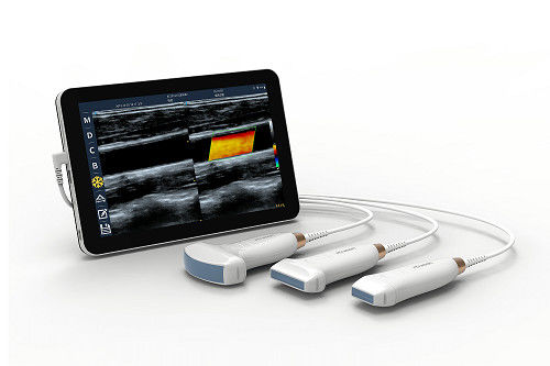 Купить Линейный портативный ультразвуковой сканер USB Type-C, портативный ультразвуковой датчик Android 10 МГц для сосудистых заболеваний и POCUS online manufacture