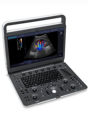 Купить 15.6inch ультразвук BW машины ультразвука СИД Sonoscape E1 Exp online manufacture