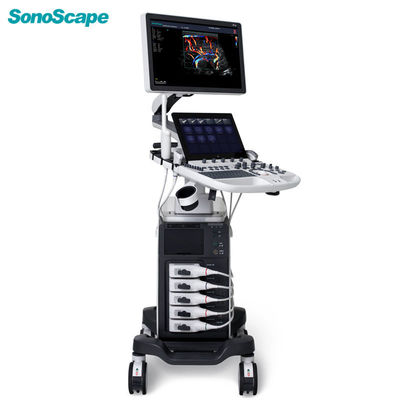 Купить Машина P50 ультразвука 500GB SonoScape с 5 гнездами online manufacture