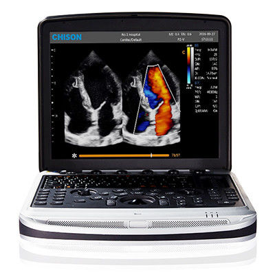 Купить Легкий для того чтобы снести машину ультразвука ноутбука 4D Chison SonoBook 9 online manufacture