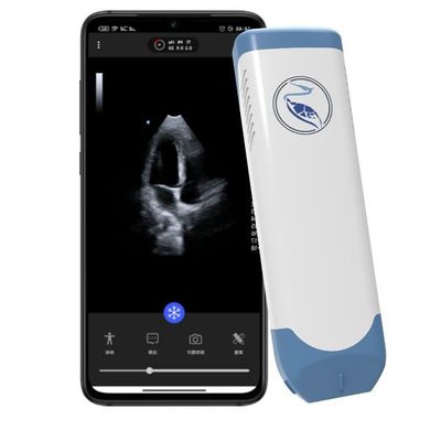 Купить Блок развертки ультразвука глубины 18.9cm Handheld для Iphone 3.6MHz online manufacture