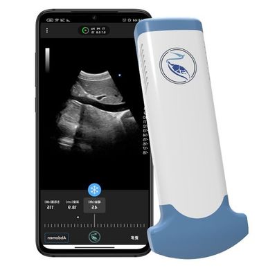 Купить Аварийный блок развертки ультразвука медицины MPEG-4 Handheld для клинической диагностической пользы online manufacture
