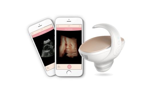 Купить CE одобренный 3D / 4D портативный ультразвуковой сканер плода
Переносное решение для визуализации беременности с выпуклым зондом широкого угла 60° online manufacture