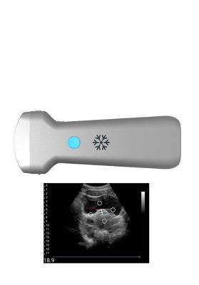 Купить Зонд ультразвука Ultrasonication выпуклый беспроводной для Gynecology online manufacture