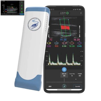 Купить 256 линий развертки зонд ультразвука датчика ультразвука Ipad беспроводной для PICC online manufacture
