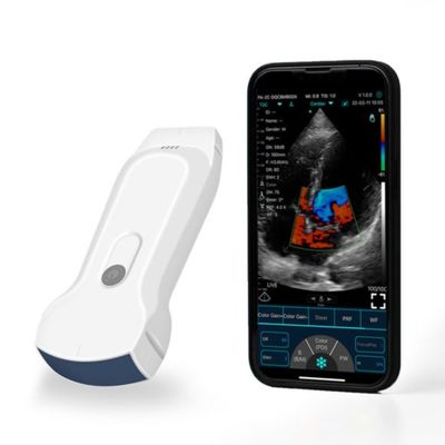 Купить Портативный ультразвуковой сканер POCUS IPad Handheld для клинического диагноза online manufacture
