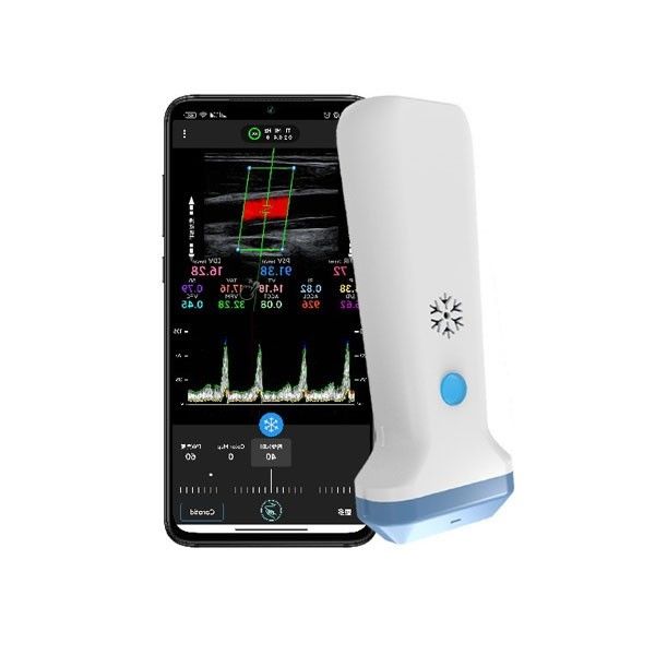 блок развертки ультразвука Doppler цвета 12.6cm портативный для профессионалов здравоохранения