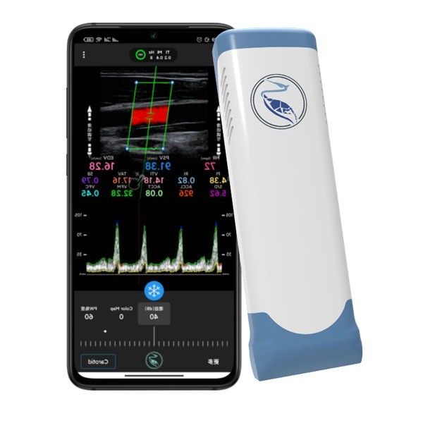 Кадры блока развертки 100 ультразвука Doppler цвета отголоска беспроводные Handheld
